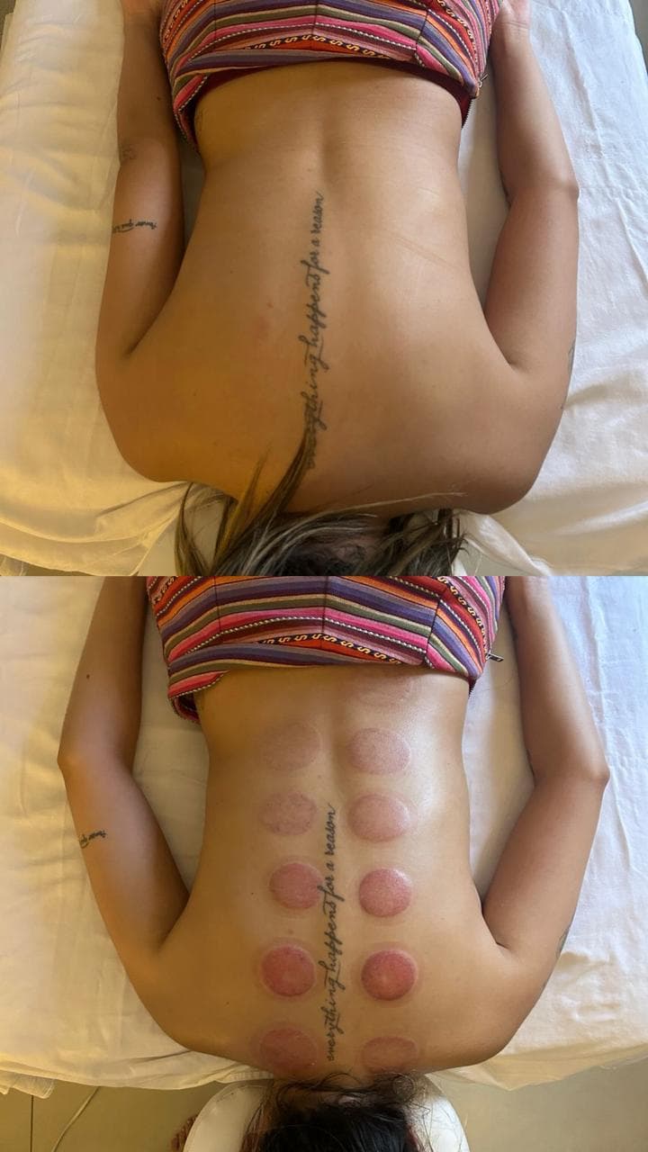 Antes e depois de liberação miofascial