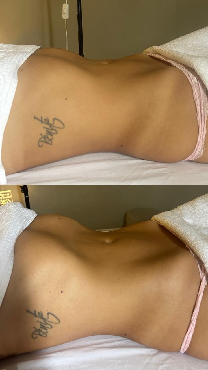 Resultado do método MAF, antes e depois da sessão